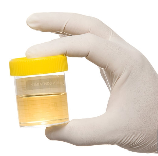 ¿Sabes lo que es la bacteriuria asintomática y cuando tratarla?

La BA es la presencia de un número significativo de bacterias en la orina:
 > 105 UFC/mL en una muestra de orina (hombres) o dos (mujeres).
> 102 UFC/ml si la muestra es estéril. 

(1/2)