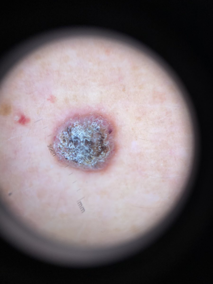 MarcelaSaebL's tweet photo. Pero ya que tengo toda su atención #UsaCubrebocas #LavadoDeManos #DistanciamientoSocial #usaprotectorsolar el cáncer de #piel va en aumento revísate #dermatología https://t.co/LY4SzxXJ5M