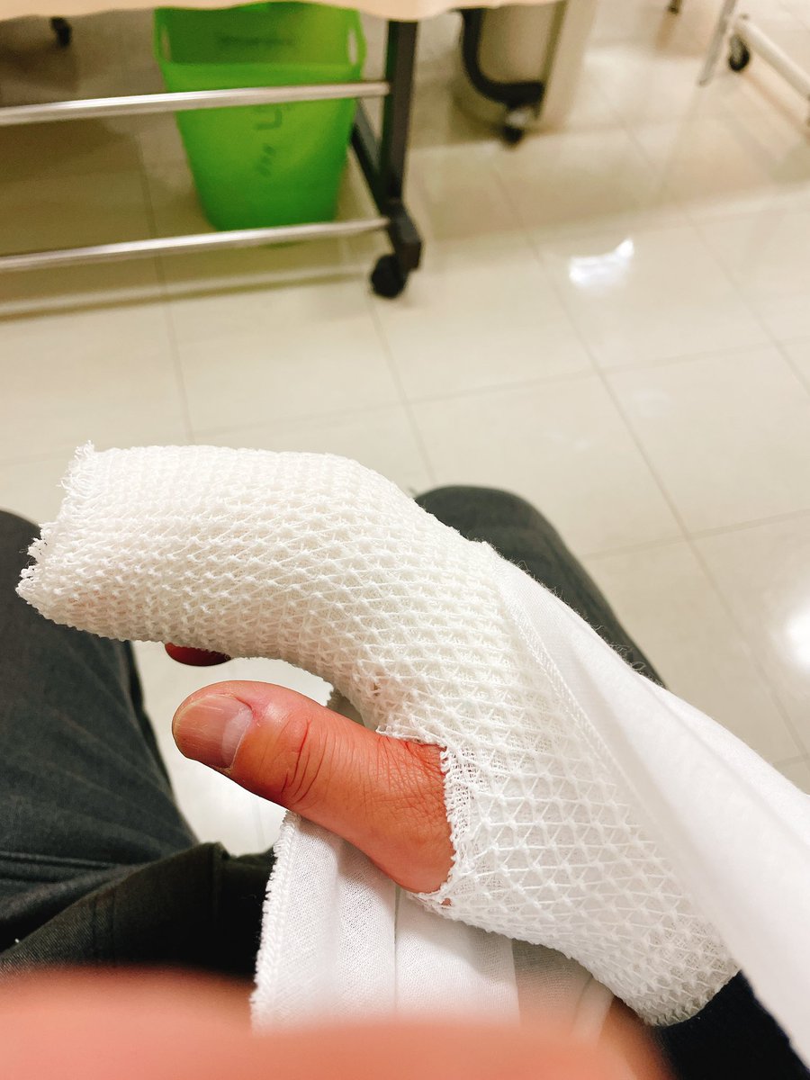 FX_arata's tweet photo. CX-5納車前日
仕事で怪我して指を複雑骨折
最悪すぎる（ ;  ; ）
＃cx5 ＃骨折 ＃マツダ https://t.co/v37gWTMAL9