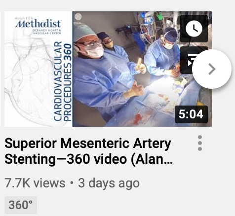 Alan Lumsden, MD, CV Chairman/Director (@alanlumsdenmd) on Twitter photo >7k views in 3 days -- lot of interest in 360 viewing! <a href="/ISEVSonline/">ISEVS</a> <a href="/VascularSVS/">Society for Vascular Surgery</a> <a href="/BLearningvideos/">BLearning</a> <a href="/VascularOnline/">Vascular Specialist Online</a> youtube.com/watch?v=Z2OSVx… >7k views in 3 days -- lot of interest in 360 viewing! <a href="/ISEVSonline/">ISEVS</a> <a href="/VascularSVS/">Society for Vascular Surgery</a> <a href="/BLearningvideos/">BLearning</a> <a href="/VascularOnline/">Vascular Specialist Online</a> youtube.com/watch?v=Z2OSVx…