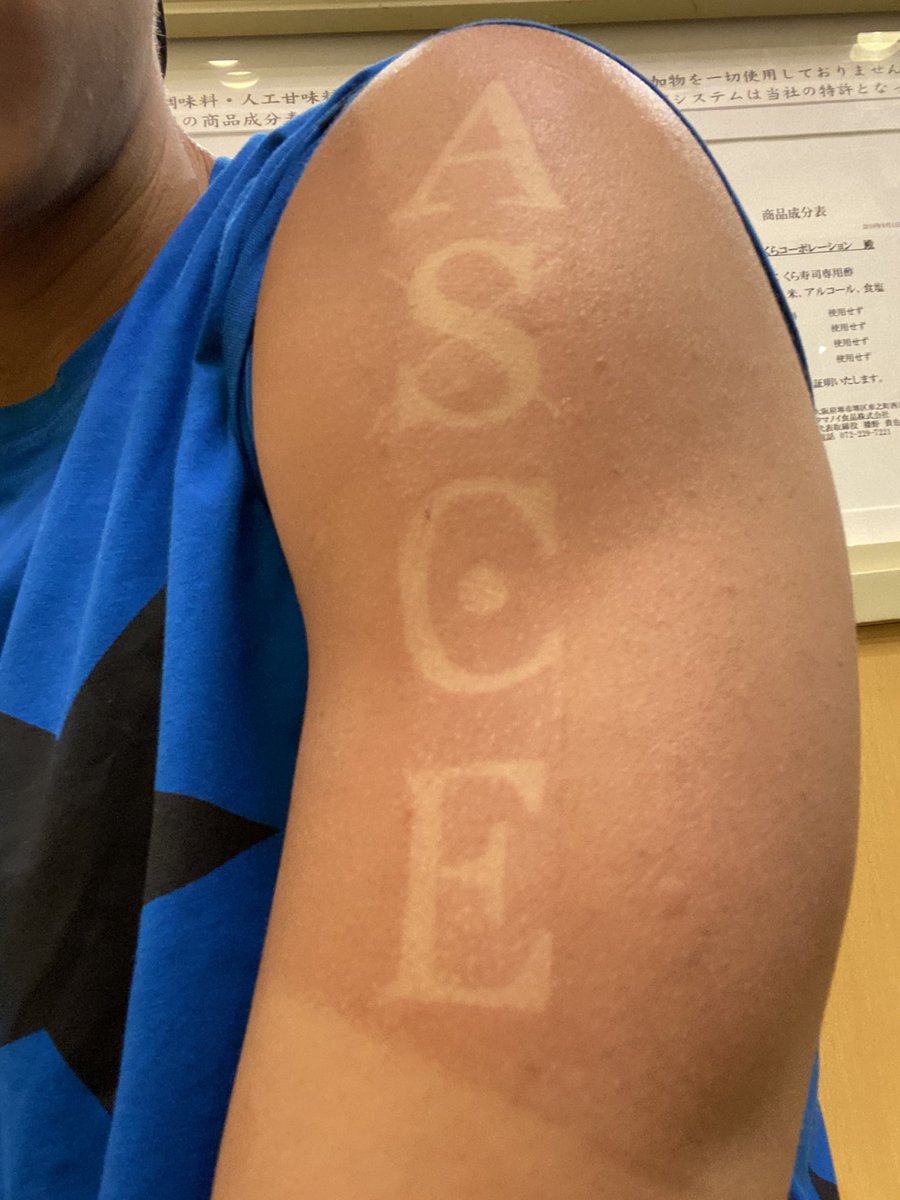 Twoucan 火拳のエース の注目ツイート コスプレ