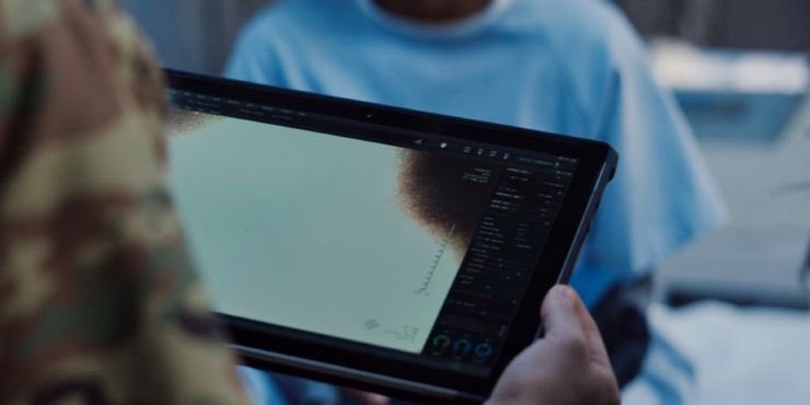 Ep 5 opens up with Monica getting tested after being kicked out of Wanda’s reality. Only the tests are all messed up including an X-Ray that basically comes back blank. The question is does Monica already have powers or have they just now been activated by Wanda?