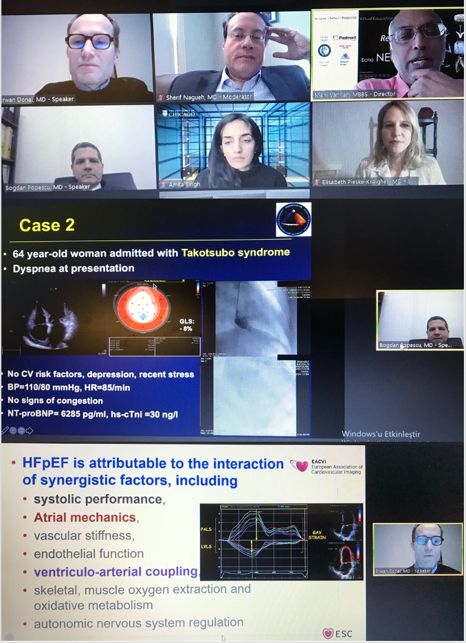 What a nice new edition of Echo New York re-Imaging on diastology and HFpEF with @donal @ManiVannanheart @bogdan_popescu1 today!!