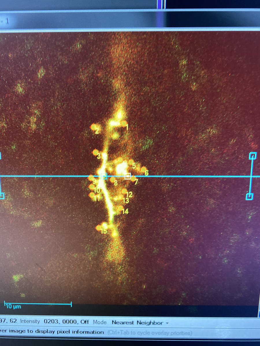 Neuroscience's tweet photo. Stupid protocol destroys the calcium response. #sciencefailure https://t.co/EYysqDrkA0