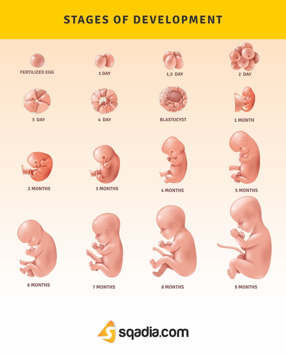 StaceyFitzgibb1's tweet photo. @DonCarlosToledo @ilyseh Looking at these diagrams of the first  where do you think the product of conception turns human?  I would say at latest 1 month. https://t.co/VbU8NmHibf