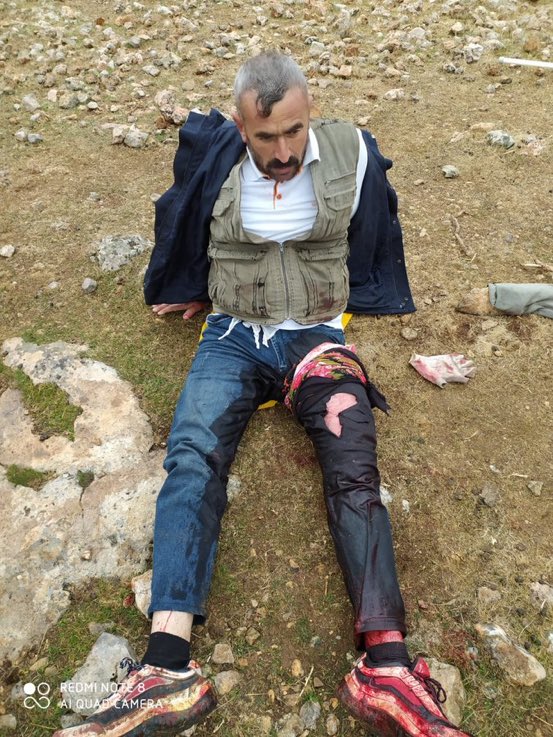 MemoFidan6's tweet photo. Söylediğim gibi bu suçsuz günahsız bir çoban bu çoban sakat kalabilir şu anda bu çoban hastanelerde yatıyor durun artık https://t.co/XoLTB894mQ