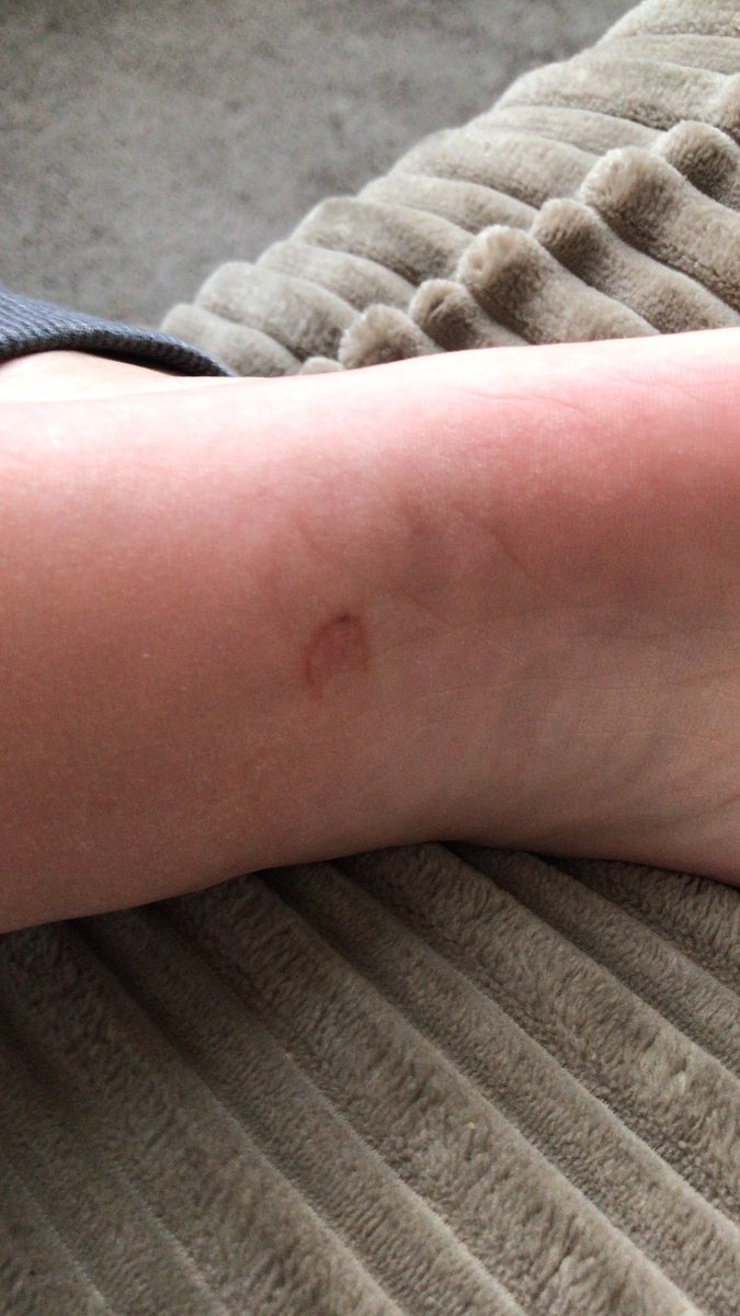 There isn’t much better than stepping on a lego at the start of your shower.