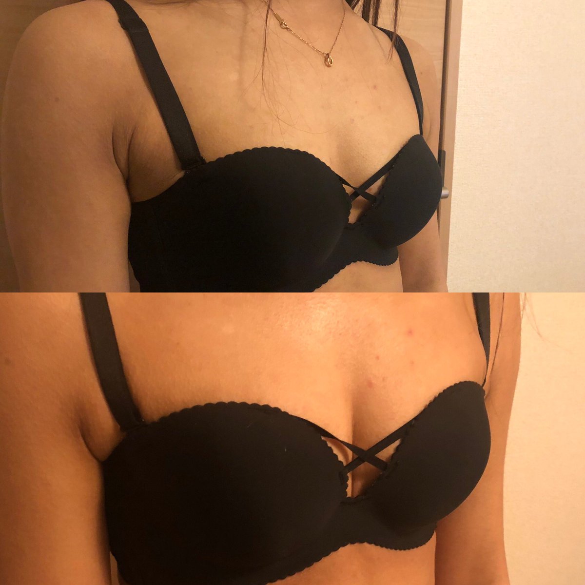 バストアップサロンrili 代女性 上before下after 見て頂きたいのは脇のお肉 バストの張り そしてなんといっても谷間 1度の施術でここまで変化します ぜひ一度カウンセリングにいらしてください カウンセリングのみ30分 0 バスト バストアップサロンrili 代女性 上before下after 見て頂きたいのは脇のお肉 バストの張り そしてなんといっても谷間 1度の施術でここまで変化します ぜひ一度カウンセリングにいらしてください カウンセリングのみ30分 0 バスト
