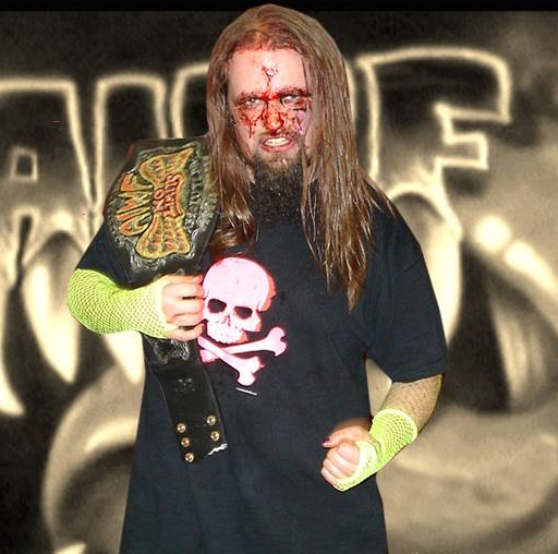Brian Danzig (AIWF Hall of Famer, whatever that means) works at a hospital. He's like the AIWF Undertaker.He pops up every now and again to stretch people, like he folded those socks all day.Dont think you can listen to King Diamond on your headphones as a hospital porter, though