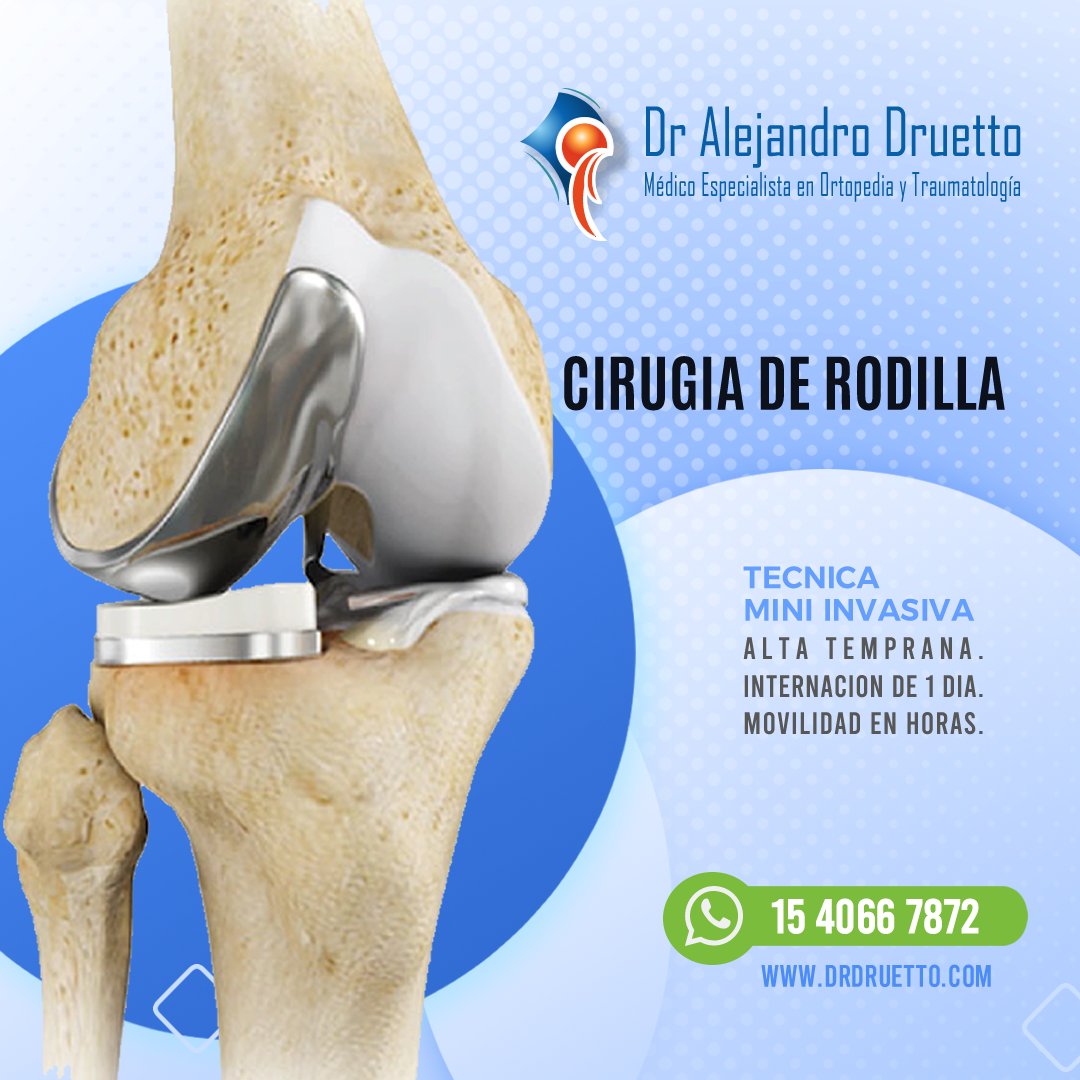 drdruetto's tweet photo. Consultanos por tu caso 
Comunicate a nuestro Whatsapp
📲  54 9 11 4066-7872
En cada detalle 🙌

▶️ ARTROPLASTIA TOTAL DE CADERA Y RODILLA con Técnica Mini Invasiva
▶️ SUPER PATH
▶️ Técnica Mini Invasiva - Mini Hip
▶️ Tratamiento Plasma Rico en Plaquetas
▶️ Tratamiento quirúrgico https://t.co/MjdU0iPEbt
