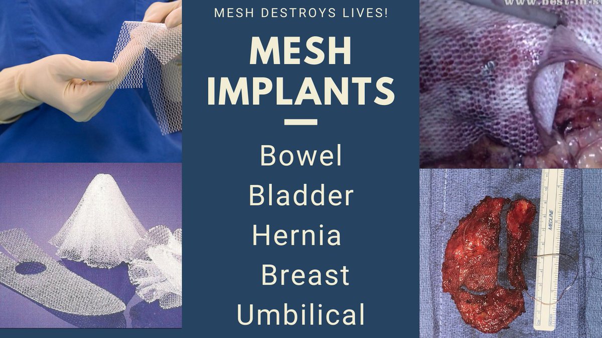 maddocks_sally's tweet photo. Our Government allowed Surgical Mesh Implants. Now, they Ignore, seriously sick &amp; injured human beings! SHAME ON OUR GOVERNMENT! 
Please sign &amp; RT ❤️⭐️
https://t.co/9yBSKP7zPj https://t.co/G6OILYoN4S
