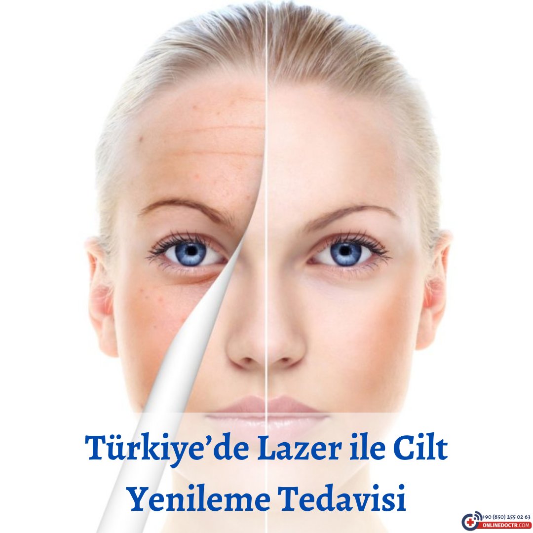 onlinedoctr's tweet photo. Yaşa bağlı ortaya çıkan ince çizgiler, mimik kırışıklıkları ve lekelenmeler cilt yenileme işlemi ile tedavi edilebilmektedir. Daha detaylı bilgi almak için OnlineDocTR üzerinden uzman doktorlar ile iletişime geçebilirsiniz.

#onlinedoktormuayenesi #onlinedoktorrandevusu https://t.co/wHb0s9Uohy