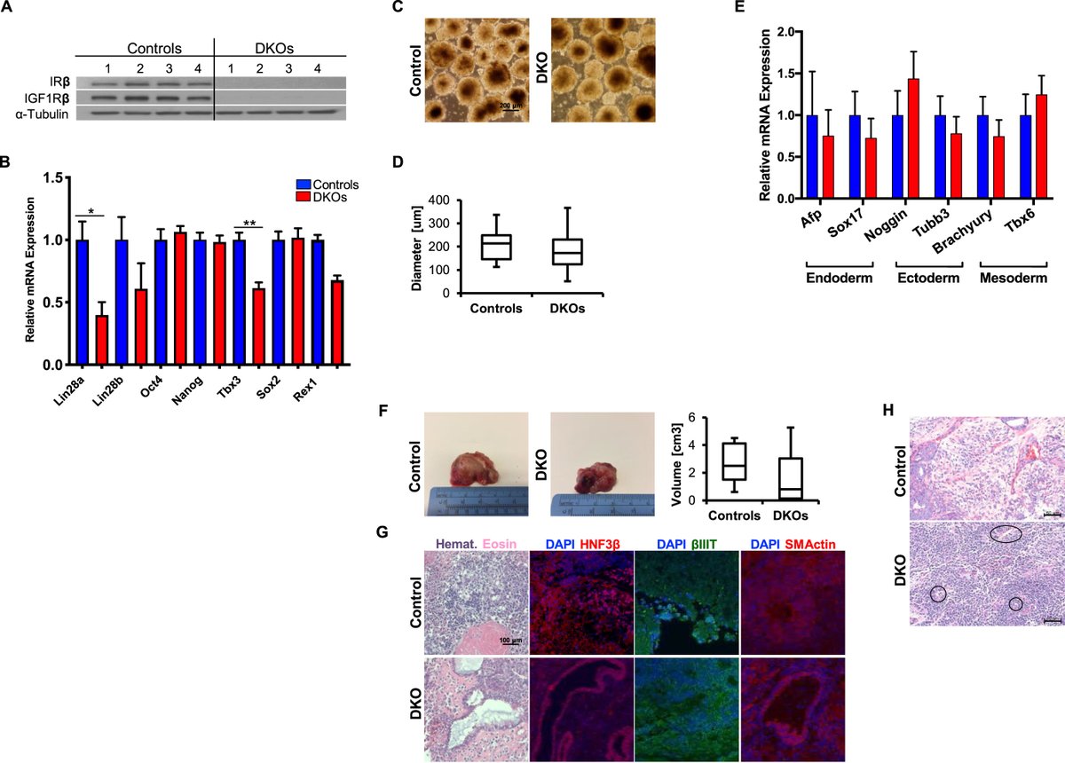 MolMetab's tweet photo. #Insulin and IGF1 receptors are important players in the development of #embryonic #tissues. New data shows that they regulate the expression of key #genes Lin28 and Tbx3.
@JoslinDiabetes @harvardmed 

➡️https://t.co/sY3CQX5zux https://t.co/whFHIP66K5