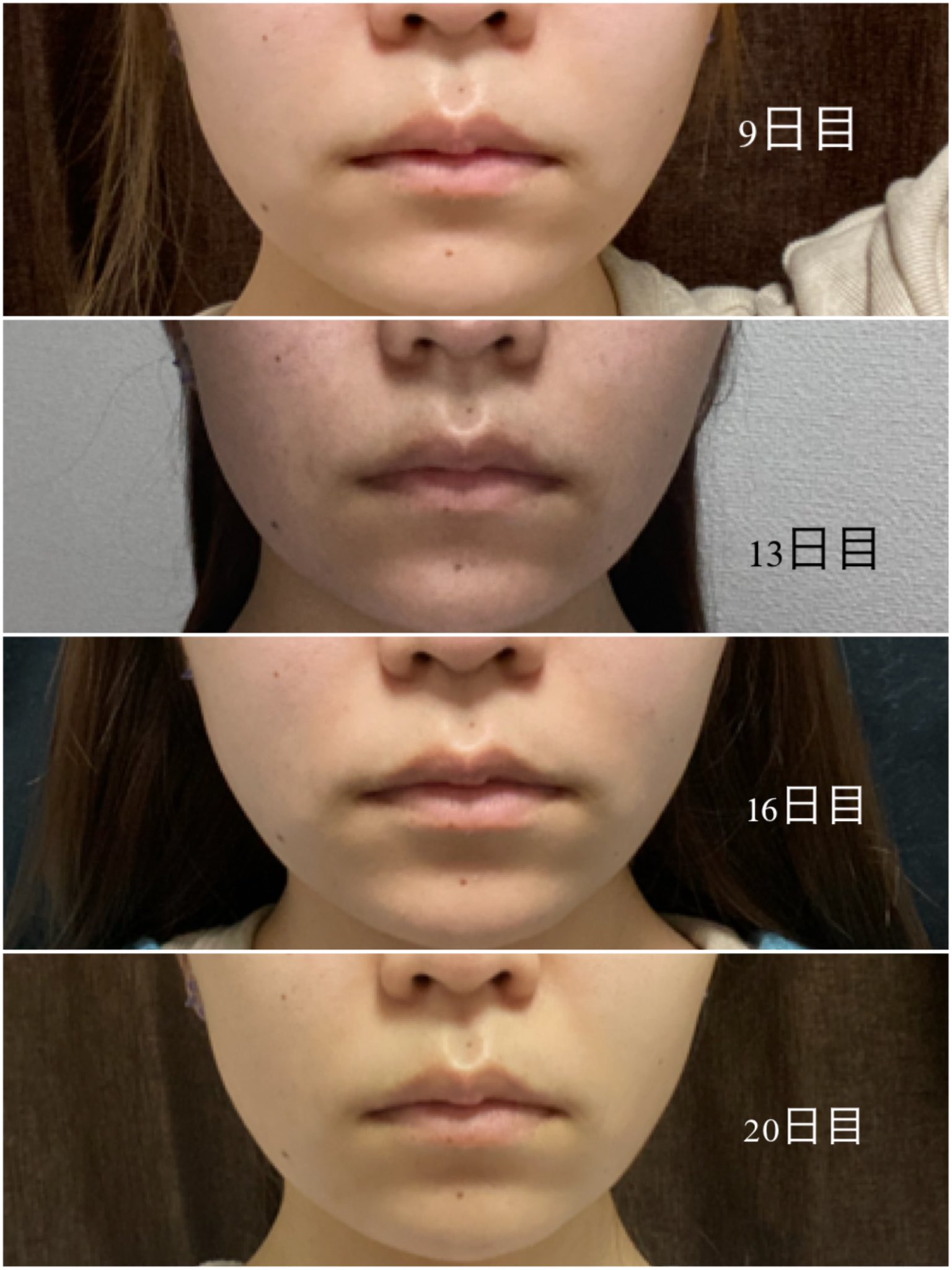 Yちゃん Svt17vhp Twitter