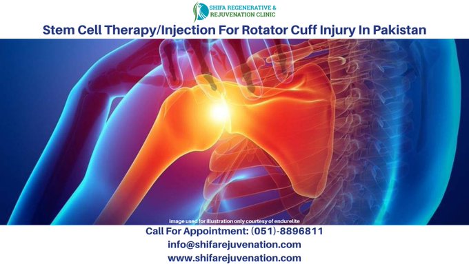 stem cell therapy for rotator cuff injury in pakistan