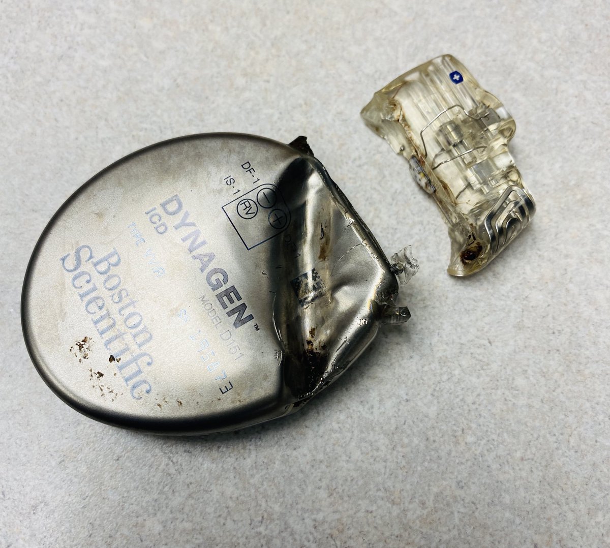 Better seen here; bullet impact split the header from the ICD can, destroyed the can, but saved a life!