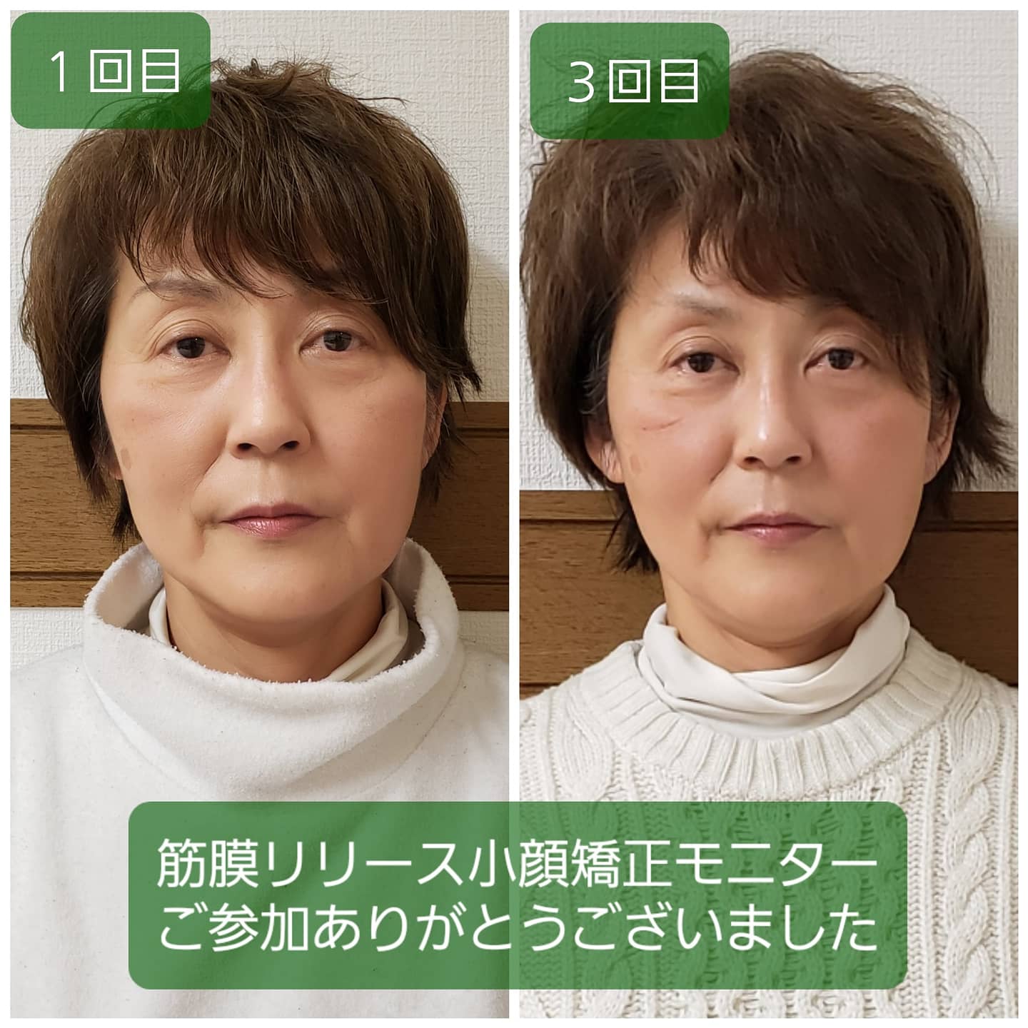 小顔Rimpulura筋膜リリース