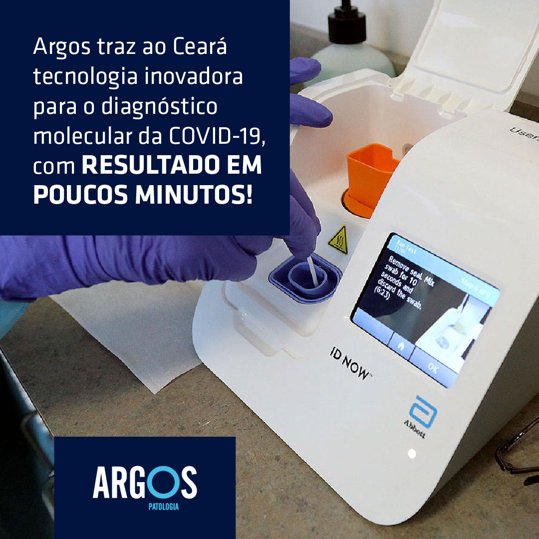 ⚠O Laboratório Argos traz a tecnologia inovadora, Abbott ID Now Covid-19, que promete entregar resultados em até 30 minutos.  ⚠

Agente o seu exame agora.👇
Fazemos agendamento somente através do Whatsapp:

☎(85) 99740 8077 - WhatsApp
☎(85) 99815 1616 - WhatsApp