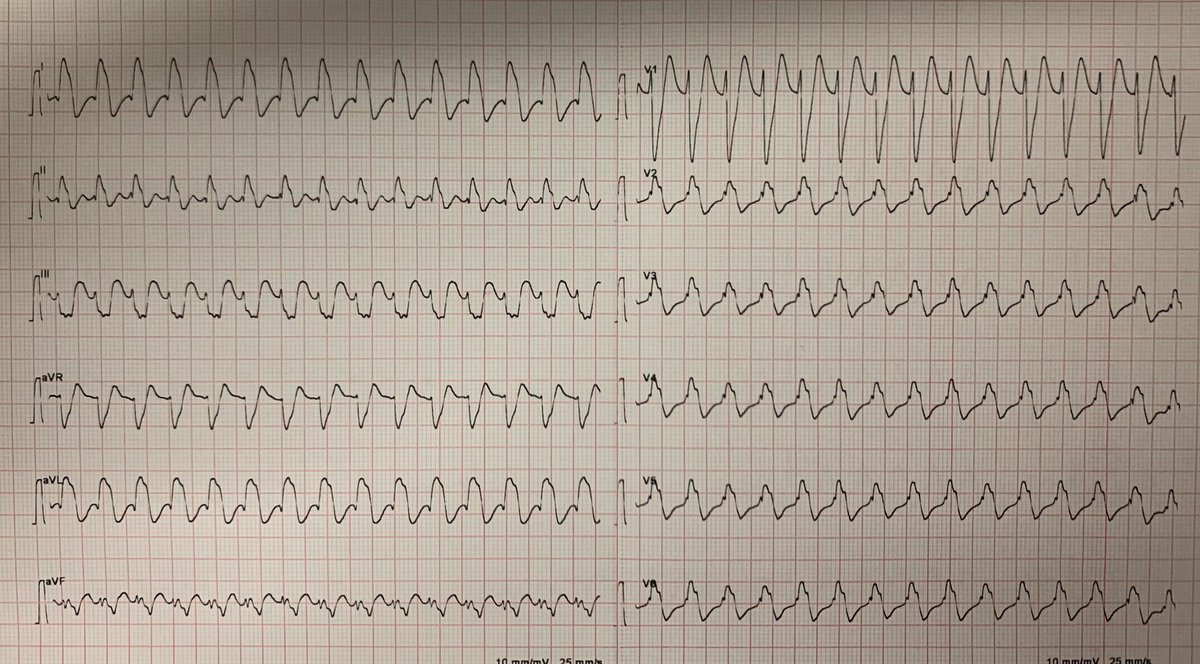 chiaraandreol12's tweet photo. Asymptomatic newborn. Diagnosis? https://t.co/v6YCiyRDb6