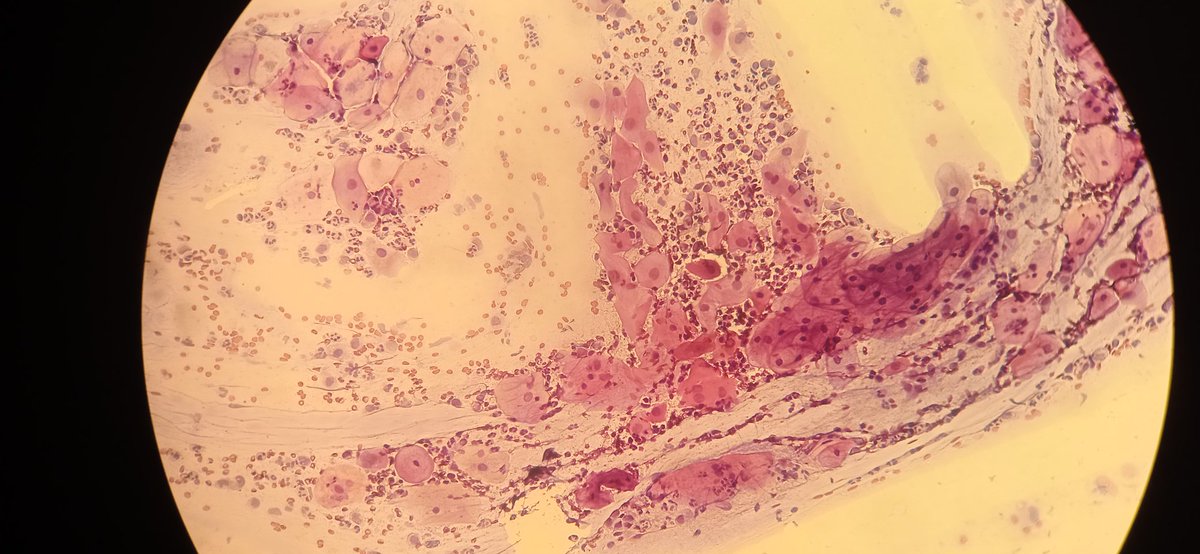 MinadjPath's tweet photo. Pap test 43F
Your diagnos? https://t.co/Pi8ZQN4H4d