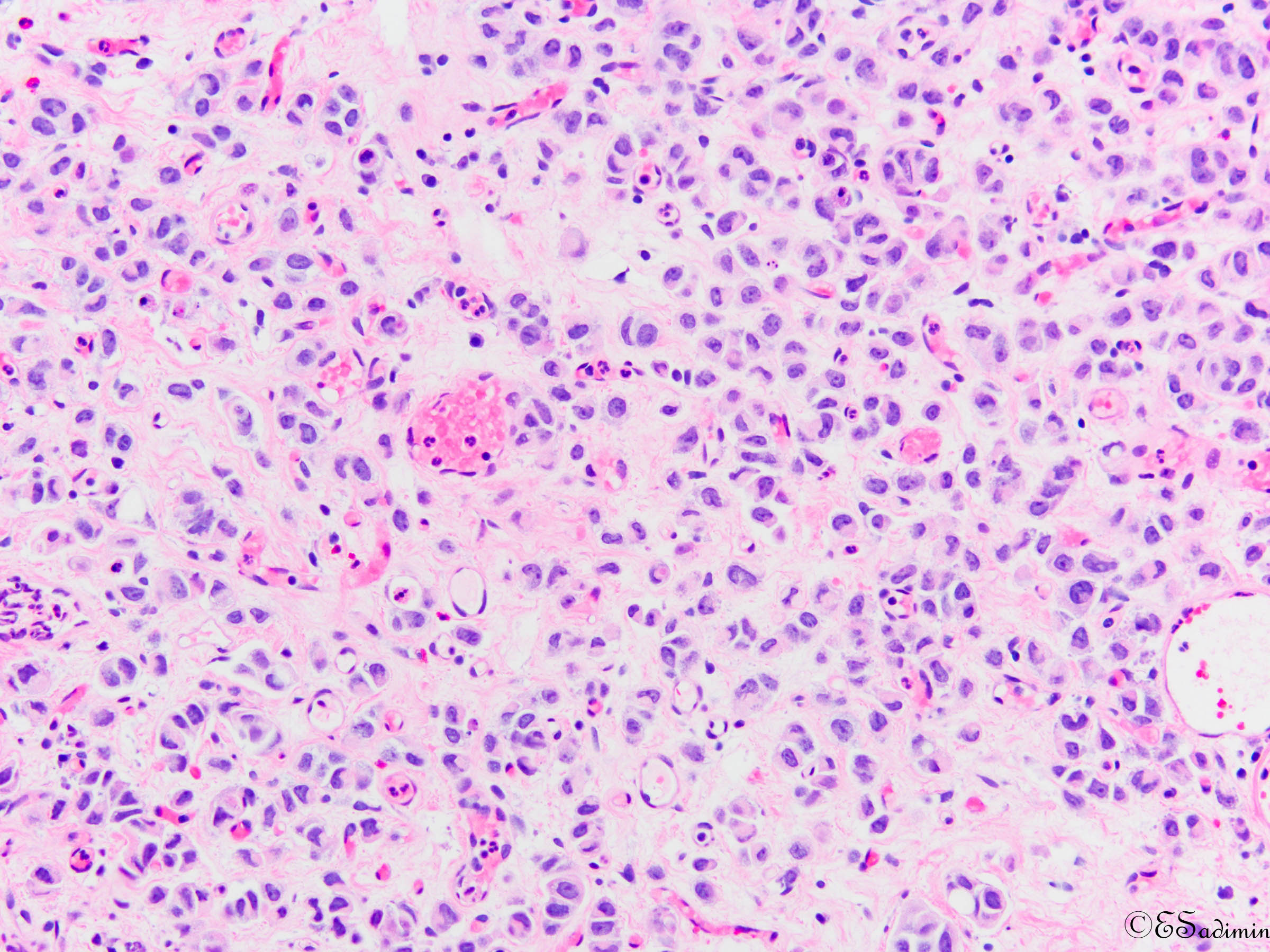 Rutgers RWJMS Pathology (PathologyRWJMS) / Twitter