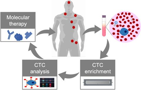 Molecular Oncology (@moloncology) on Twitter photo Don't miss the latest review article of <a href="/MahmoudAMLabib/">Mahmoud Labib</a> and <a href="/ShanaOKelley/">Shana Kelley</a> @KelleyLabUofT on #CTC profiling for #PrecisionMedicine
⬇️
buff.ly/2O9O6X2 Don't miss the latest review article of <a href="/MahmoudAMLabib/">Mahmoud Labib</a> and <a href="/ShanaOKelley/">Shana Kelley</a> @KelleyLabUofT on #CTC profiling for #PrecisionMedicine
⬇️
buff.ly/2O9O6X2