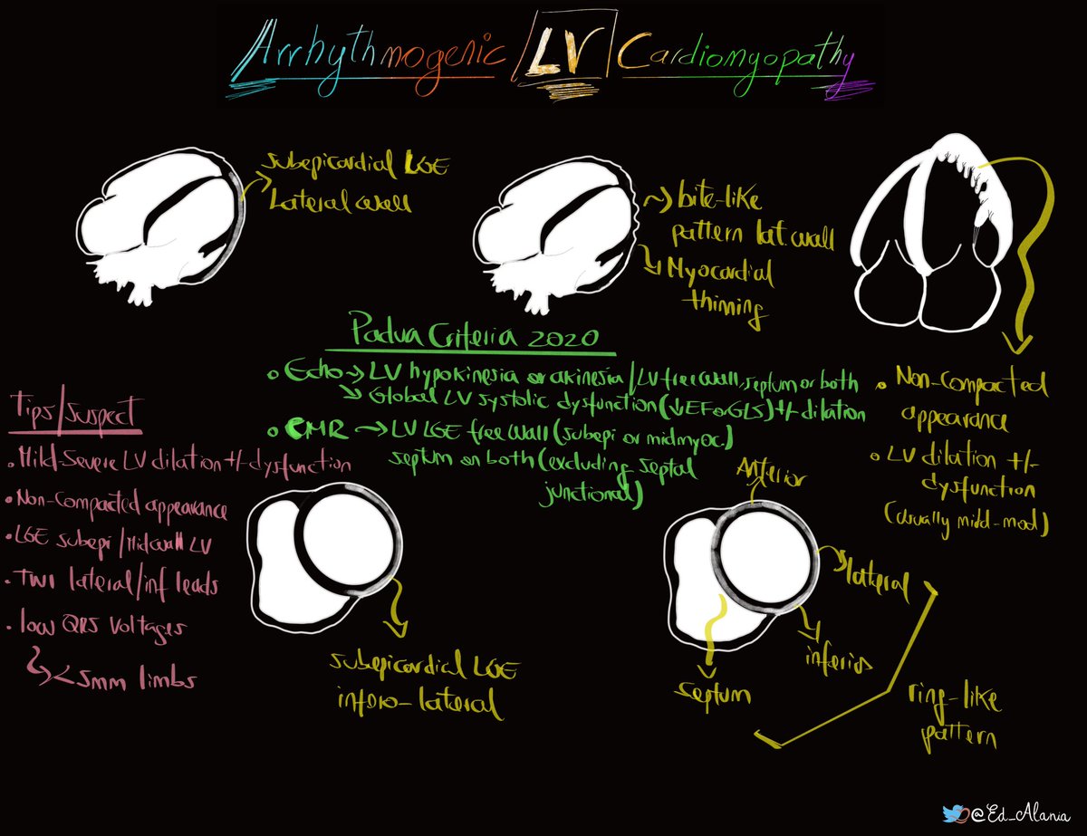⚡️Arrhythmogenic LV Cardiomyopathy🫀Part III #CardioEd #echofirst #whycmr #ENARM #Cardiology @AshwagEcho <a href="/The_echo_lady/">The Echo Lady</a> <a href="/CardioCaribeMx/">Cardiopaps</a> <a href="/NMerke/">Nicolas Merke</a> <a href="/RodrigogpLima/">Rodrigo G P Lima</a> <a href="/JuliaSellerm/">Julia Seller</a> <a href="/iamritu/">Ritu Thamman MD</a> <a href="/purviparwani/">Dr. Purvi Parwani</a> <a href="/denisamuraru/">Denisa Muraru</a> <a href="/alessia_gimelli/">Alessia Gimelli</a> <a href="/PeroneFrancesco/">Francesco Perone</a> <a href="/KristinaHaugaa/">Kristina  Haugaa</a> <a href="/Hragy/">Hany Ragy</a> <a href="/AmitGoyalMD/">Amit Goyal MD MAS</a>