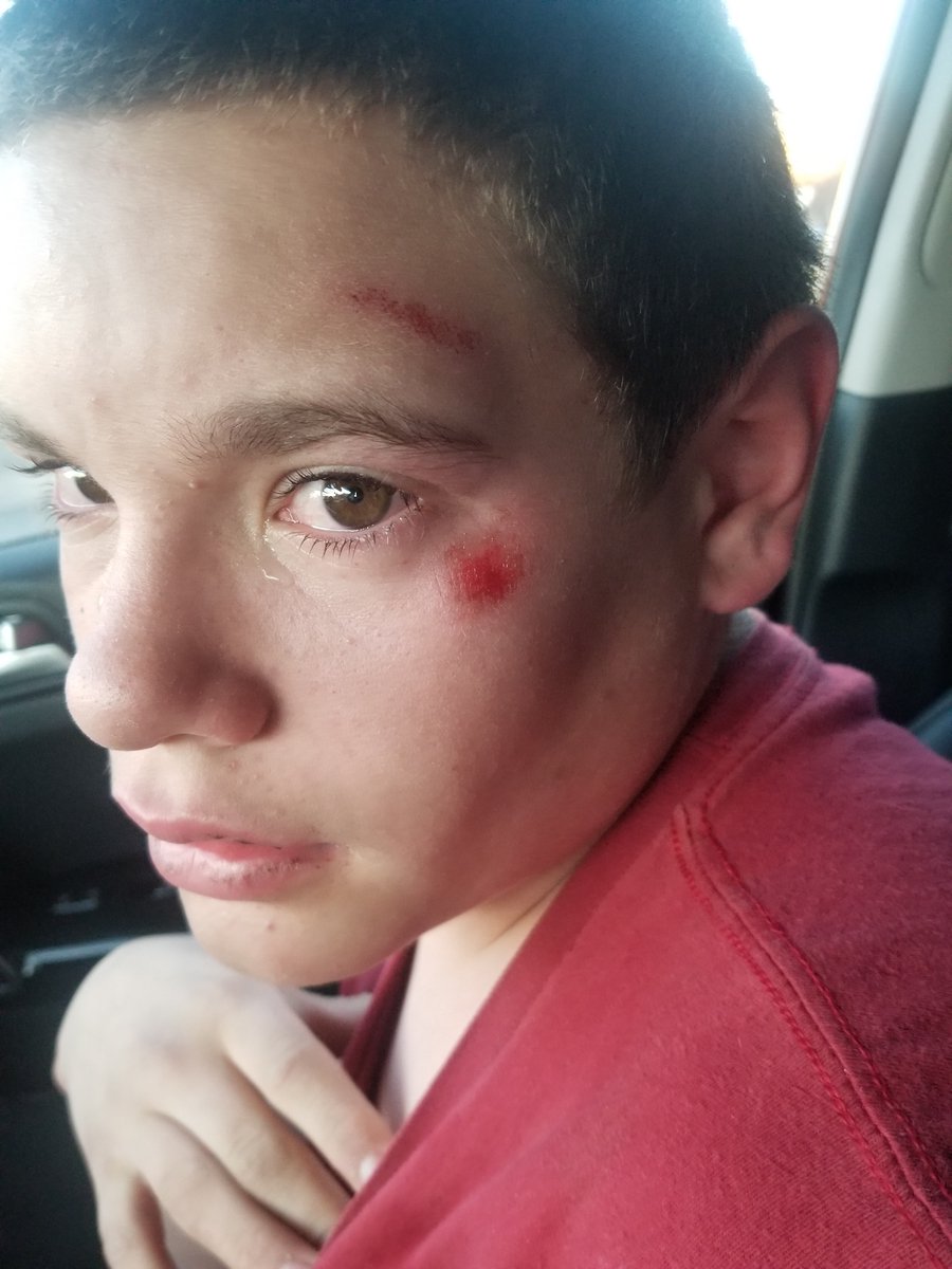 BrittanyGlasTV's tweet photo. This is Remick on that day... It all started after he got into a fight with his classmates on the FrontRunner platform. Although autism is an invisible disability, Remick's mother believes the @WoodsXPolice officers who responded to the call were too aggressive. @KSLInvestigates https://t.co/ve8uoDGezg