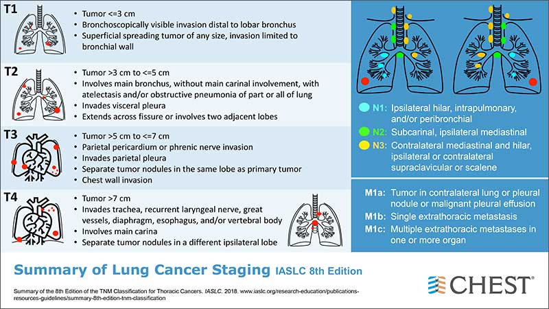 #lungcancer #staging <a href="/IASLC/">IASLC</a> 8th edition

<a href="/accpchest/">CHEST</a> <a href="/CHESTOncology/">CHEST Thoracic Oncology & Chest Procedures</a> #CHESTOnc #CHESTIP #CHESTIPTeam <a href="/PannuJasleen/">Jasleen Kaur Pannu 🫁 🇮🇳🇺🇸</a> <a href="/PCubedMD/">Priya P. Patel</a> <a href="/AbbieBegnaud/">Abbie Begnaud, MD, FCCP</a> <a href="/ahalraiyes/">AB Alraiyes</a>