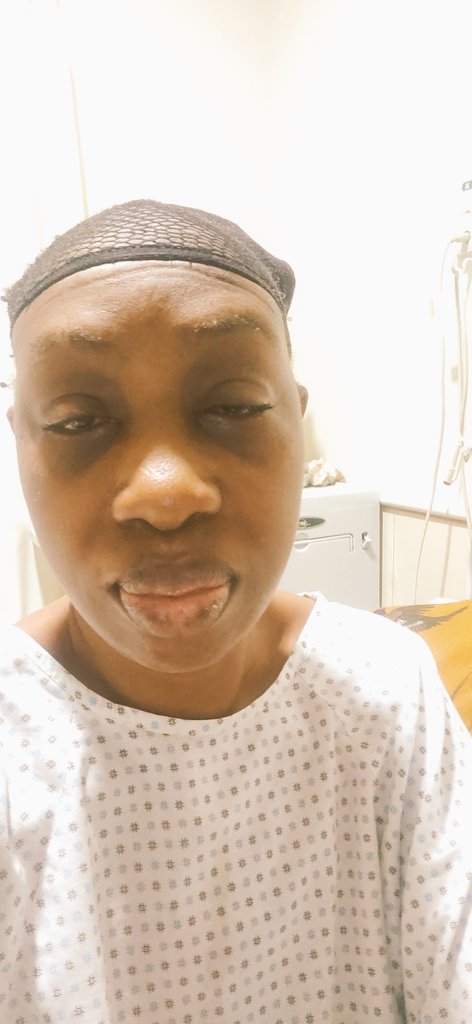 It's been a rough 24 hours in constant pain but still hopeful... It can only get better right... It's a beautiful day... Still alive day 8 on admission #getwelljeni