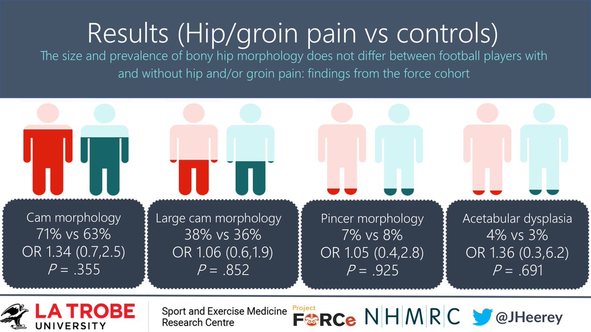 Study 4. jospt.org/doi/10.2519/jo…
In sub-elite football players
💥No diff in alpha angle or LCEA between football players with and without hip/groin pain
💥Cam morphology present in football players with (71%) and without (63%) hip/groin pain