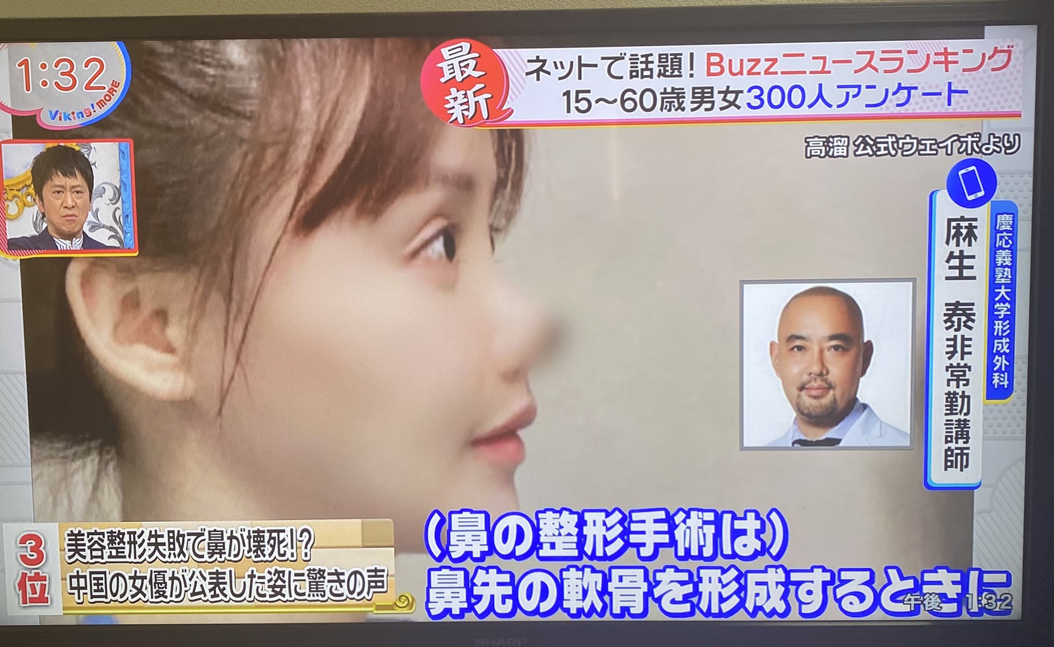Tkc 事務局 東京美容外科 麻生院長が見解を求められた中国若手女優の鼻の壊死 東京美容外科のドクターは何度も韓国のクリニックに研修に行き高度な技術を取得しています 存在感のない鼻 他院さまの修正など傷跡や合併症のセカンドオピニオンも Tkc 事務局 東京美容外科 麻生院長が見解を求められた中国若手女優の鼻の壊死 東京美容外科のドクターは何度も韓国のクリニックに研修に行き高度な技術を取得しています 存在感のない鼻 他院さまの修正など傷跡や合併症のセカンドオピニオンも