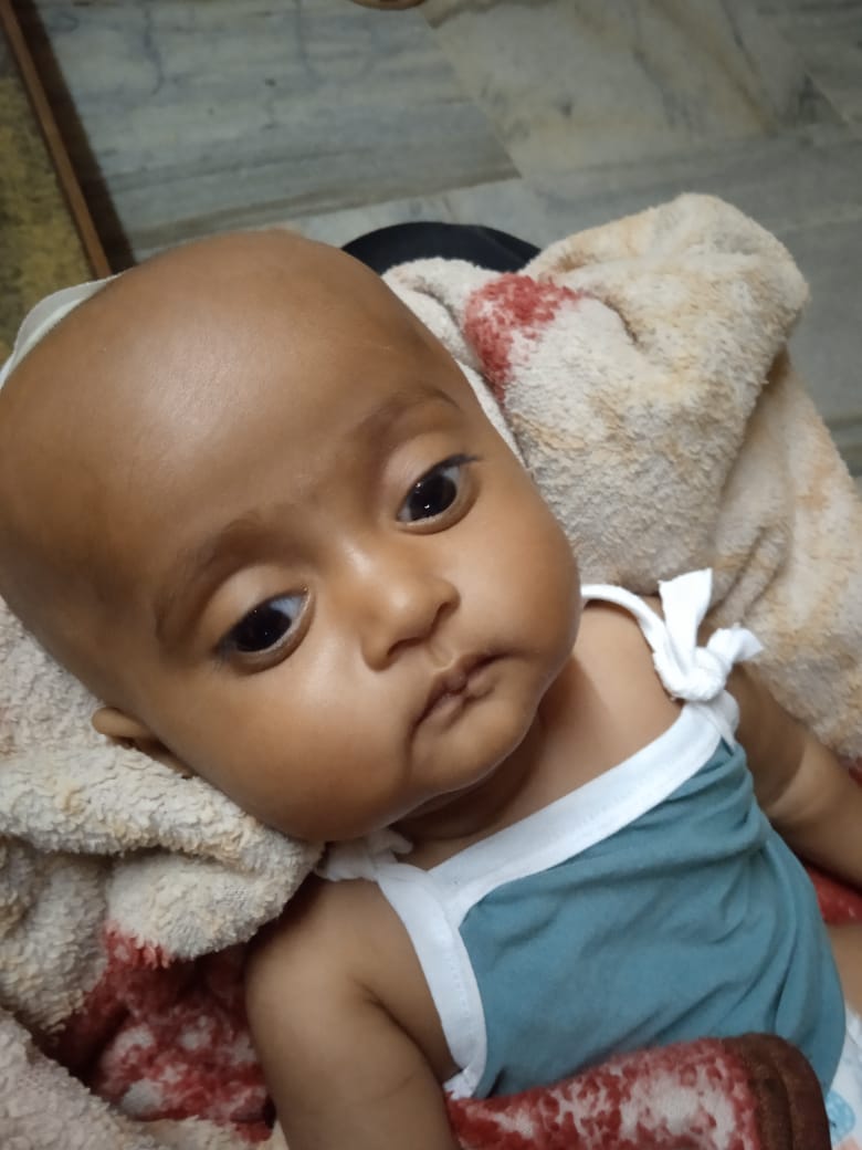 Bamahdi's tweet photo. @KTRTRS @TelanganaCMO New Born baby #AnabiyaFatima #Div31 @MC_Nizamabad @Collector_NZB suffering from
#UncalHerniation admitted #OsmaniaHospital advised immediate #BrainSurgery to remove #BloodClots to save her precious life.. Kindly extend financial assistance under #ArogySri https://t.co/2IU1mgrNUZ