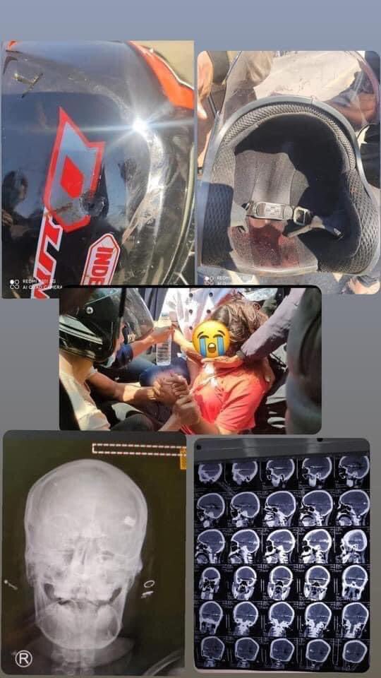 Hmwe23's tweet photo. ARMED POLICE killed a PEACEFULLY protesting 19-year-old ‼️

(Warning: The content contains images that may be disturbing to some.)
Please PROTECT HUMAN RIGHTS! United Nations Permanent Mission of Myanmar to the United Nations

HEAR OUR VOICE
#WhatsHappeningInMyanmar #Myanmar https://t.co/aobzSqgBM7