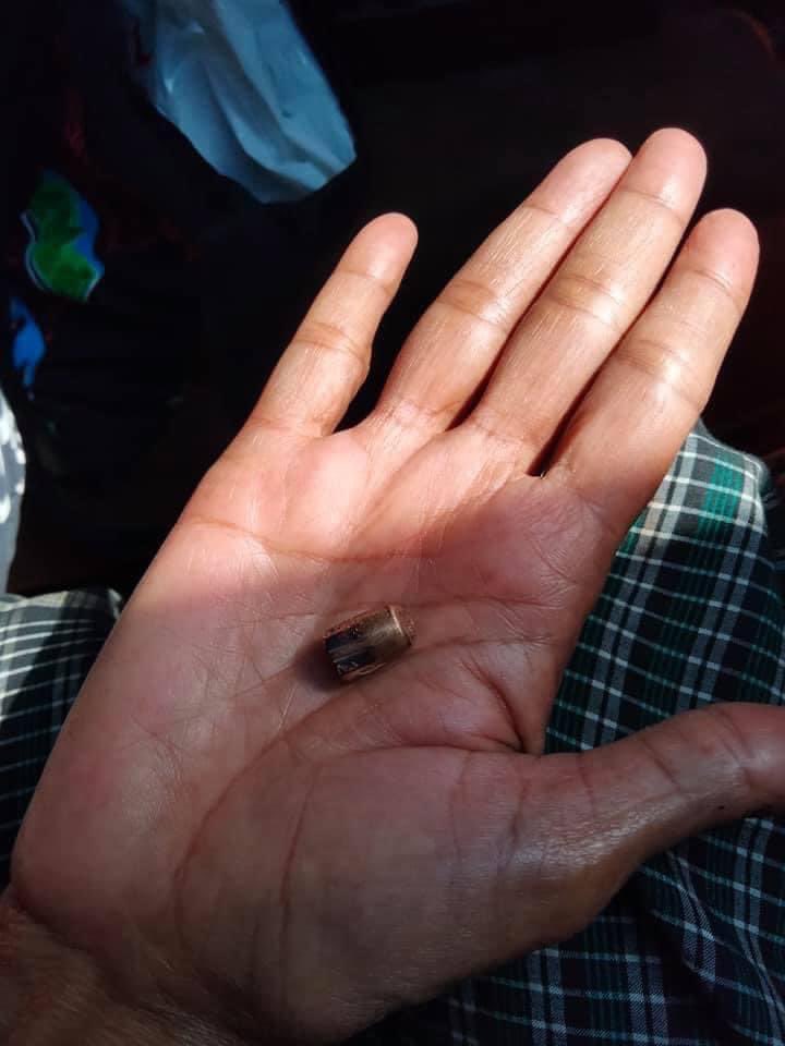 In Naypyitaw Police and Military start shooting with real gun. A girl  and a boy were shot. 
A girl fainted in emergency room and A boy in the operation room .
TW: dead
#WhatsHappeningInMyanmar
#Feb9Coup
