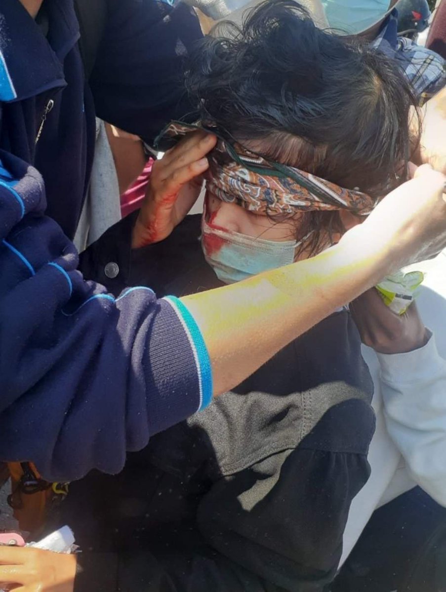 How police shooting at the three finger salute peaceful demonstrations at Myanmar.

GCS 3 Head Injury 1, Open Chest Injury 1

#WhatsHappeningInMyanmar
#PeacefulProtestMyanmar
#Coup9Feb
#CivilDisobedienceMovement 
#SaveMyanmarDemocracy
#FightForDemocracy
#HearTheVoiceOfMyanmar