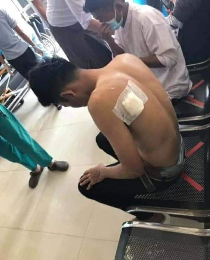 The police opened fire on  people protesting
TW:blood and violence,gunshot
#WhatsHappeningInMyanmar 
#Feb9Coup