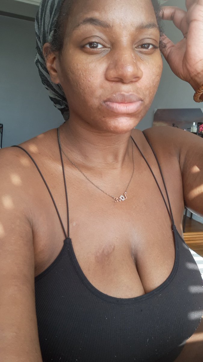 OneFormula_Love's tweet photo. So, I decided to participate in CVS's #BeautyUnaltered campaign using my favs from this week's editorial. Because selfies hit different when their always w/o makeup &amp; filters. Beauty in real life! 💋💋💋 #CVS #CVSBeauty #LOVE 

<3 <3 <3 <3 <3 <3 {^_^} <3 <3 <3 <3 <3 <3 https://t.co/AqEQTeS3hh