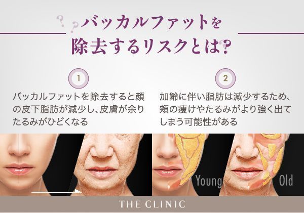 バッカル ファット と は