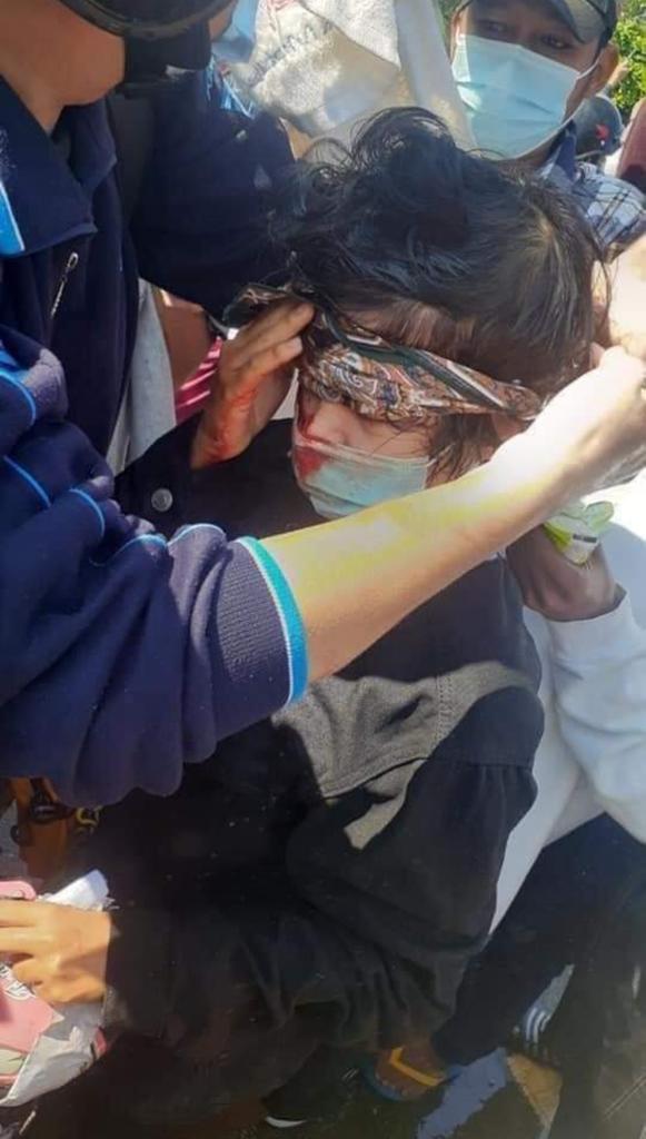 In Naypyitaw, captial city of Myanmar, police used water pressure truck &amp; made harmful to the people who were demonstrating peacefully. And there are still over 10 injured citizens.
#HearTheVoiceOfMyanmar 
#SaveMyanmar 
#RejectTheMilitary
#WhatishappeninginMyanmar
