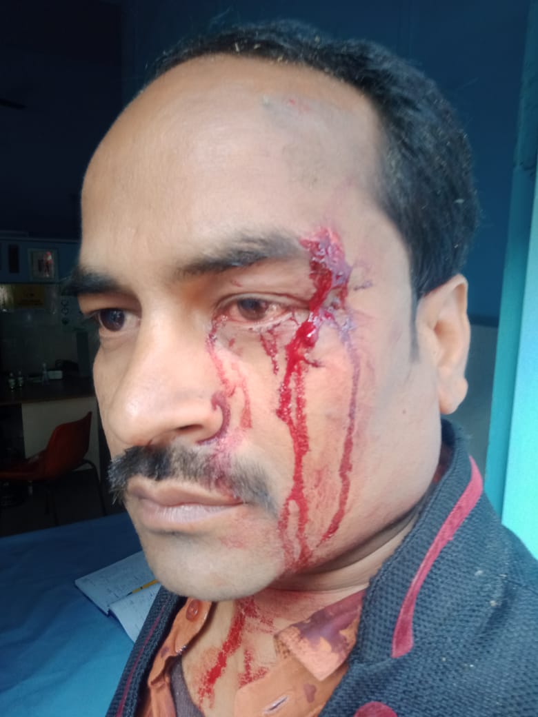 AIRAAssociation's tweet photo. कानपुर के थाना बादशाहीनाका क्षेत्र में पत्रकार दिग्विजय सिंह पर दबंगों द्वारा हमला किया गया है। उच्च अधिकारियों से अनुरोध है कि इस प्रकरण में उचित एवं सख्त कानूनी कार्यवाही करवाने की कृपा करें
@igrangekanpur 
@adgzonekanpur 
@kanpurnagarpol 
@dgpup 
@Uppolice https://t.co/JxGmBwHJNN