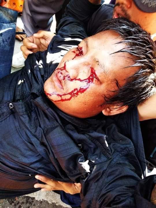 May19744698's tweet photo. We are suffering from Military Coup. 
Coup Government is not our Government. 
We want our elected government. 
Support us as you can.
#WhatsHappeningInMyanmar 
#Feb9Coup 
tw//blood and violence https://t.co/2yncxwxRWW