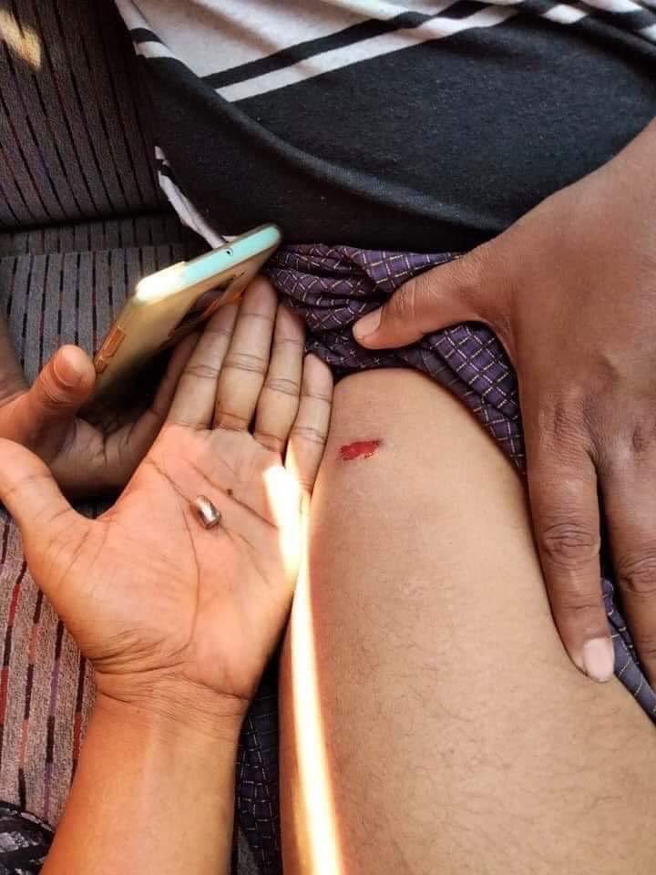 GenicMyo's tweet photo. The police shoot on innocent People during Protesting in Nay Pyi Taw #WhatsHappeningInMyanmar #Feb9Coup https://t.co/lFyA2DlK24