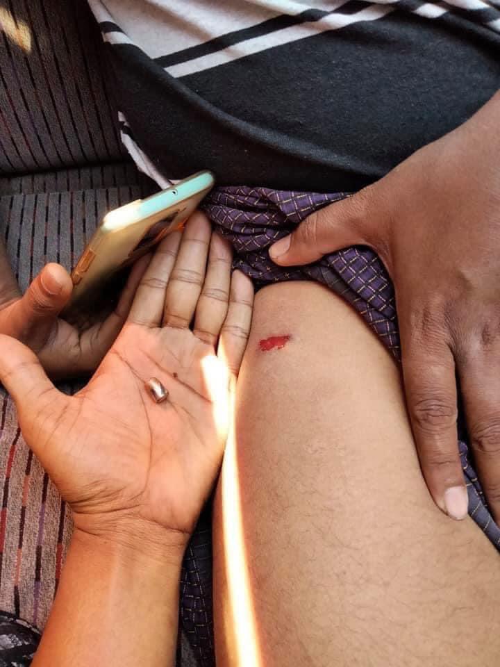 AzualJ's tweet image. Police shooting protesters who are protesting peaceful in their own space. 🙌🏻😭

#HearTheVoiceOfMyanmar 
#RejectTheMilitaryCoup 
#SaveMyanmar