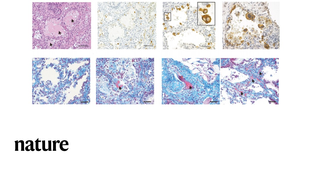 NaturePortfolio's tweet photo. Oral administration of an antiviral drug, EIDD-2801, in immunodeficient mice transplanted with human lung tissue inhibits SARS-CoV-2 replication and can prevent infection, according to a paper in Nature. https://t.co/BtoxhN6b6t https://t.co/R1acycpU5r