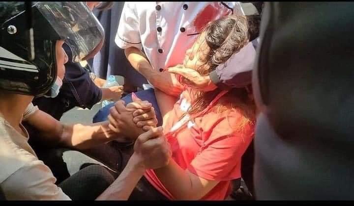 How police shooting at the three finger salute peaceful demonstrations at Myanmar.
GCS 3 Head Injury 1, Open Chest Injury 1
#WhatsHappeningInMyanmar
#PeacefulProtestMyanmar
#Coup9Feb
#CivilDisobedienceMovement 
#SaveMyanmarDemocracy
#FightForDemocracy
#HearTheVoiceOfMyanmar
#crd