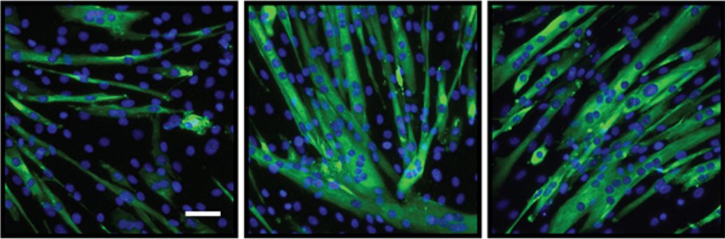 Dev_journal's tweet photo. Muscling in on TGFβ-independent functions for SMAD2

A Research Highlight showcasing new work from Émilie Lamarche, @nwbergeron &amp; colleagues

https://t.co/3fprdXi25o https://t.co/xklYO2Ioes