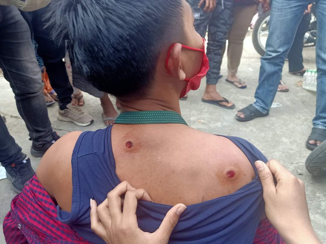Jeon97San's tweet photo. The military and police shot protesters who are protesting peacefully in streets with water cannon and rubber bullets. 
A few of them  got injuries. 
Please, don’t turn a blind eye to Myanmar people who want Democracy and freedom.
#Feb9Coup
#WhatsHappeningInMyanmar
Hear Our Voice https://t.co/ur77hdrxRZ