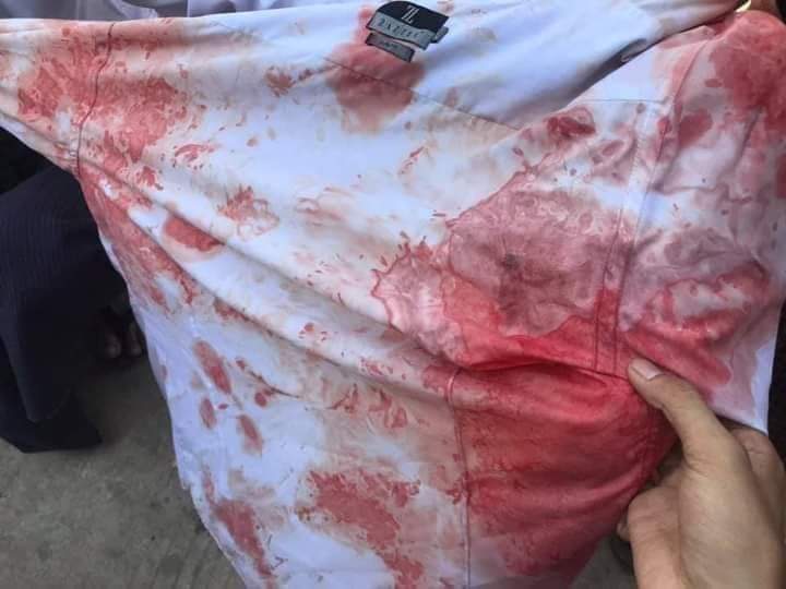 KoeeKoee2's tweet photo. Myanmar police and military shot with real bullets. Sources reported at least 3 were shot and rushed to the hospital. They also used chemical water and tear gas bombs.

#Feb9Coup 
#WhatsHappeningInMyanmar https://t.co/bzLMwqZRKr