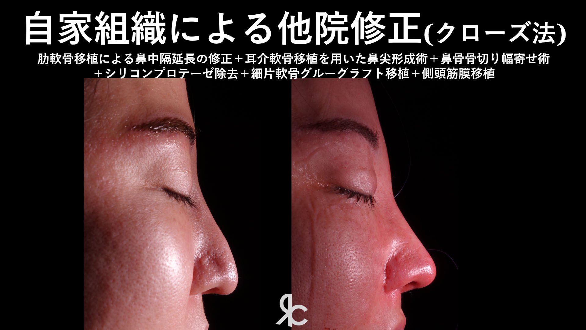 魔女鼻 Twitter Search Twitter